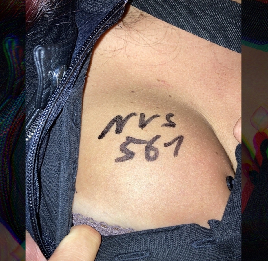 FANS_12a_nervenserum_561_etc